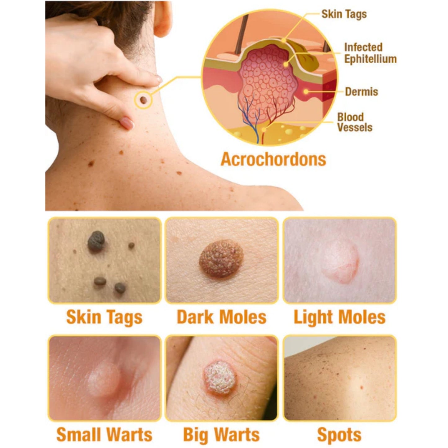 (🔥Last Day Promotion 70% OFF)🐝TagRecede Bee apiotherapy Treatment Spray