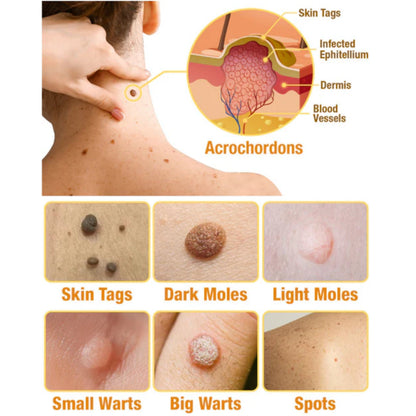 (🔥Last Day Promotion 70% OFF)🐝TagRecede Bee apiotherapy Treatment Spray