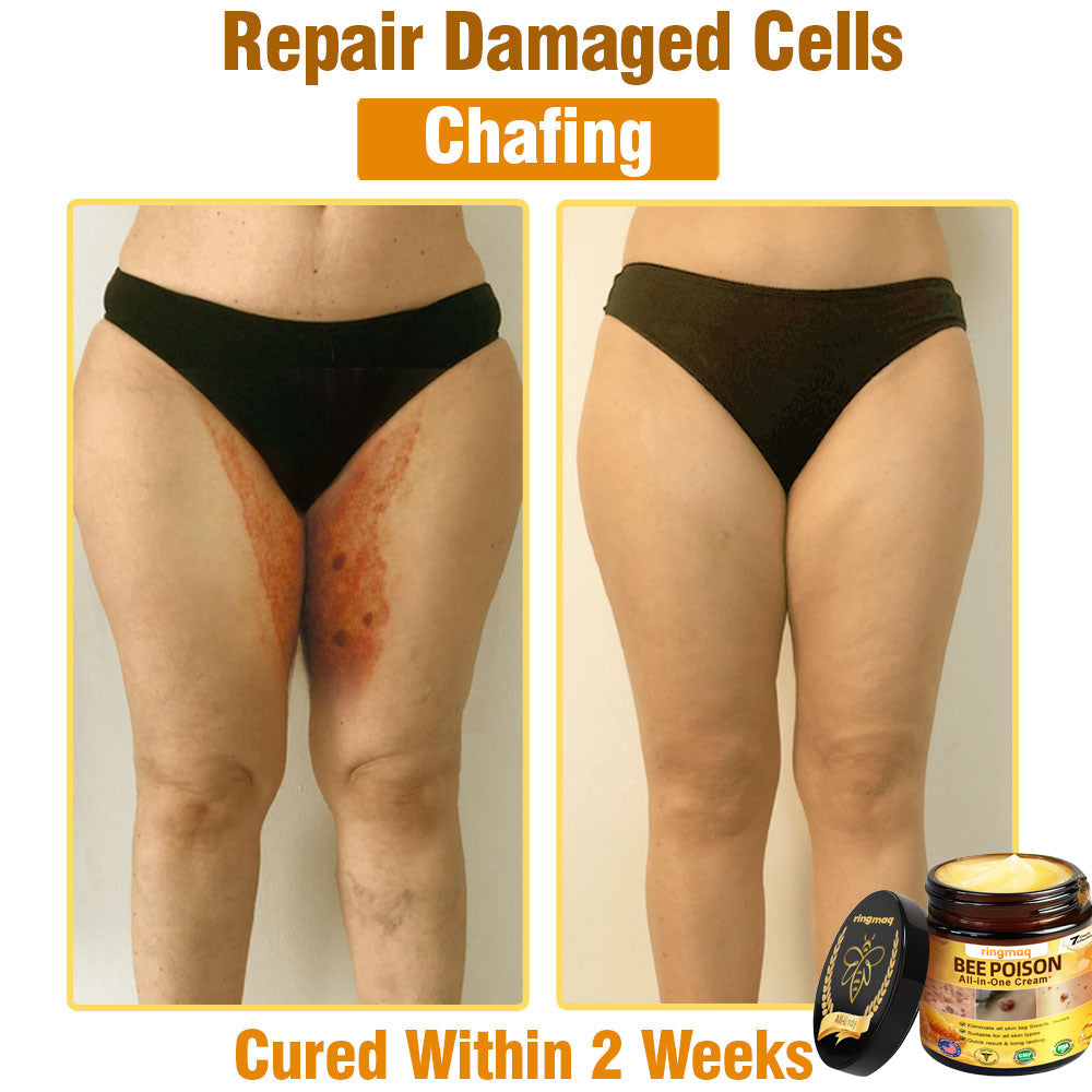 ringmaq Bee Poison All-in-One Cream US Dermatologist Approved
